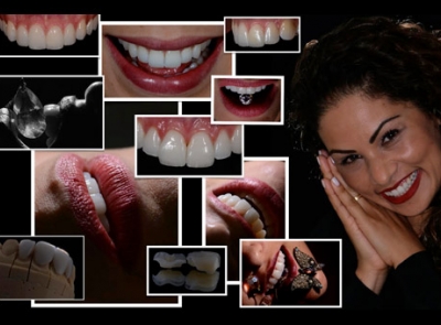 Curso Avançado de Fotografia Odontológica & Artistica