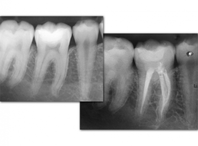 Imersão VIP de Endodontia Automatizada & Alta Tecnologia