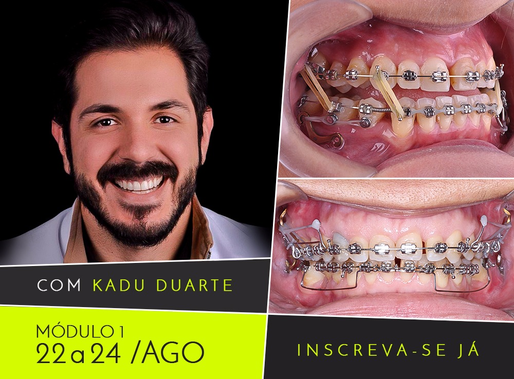 Ortodontia Multidiciplinar: Diagnósticos 3D & Ancoragens Esqueléticas