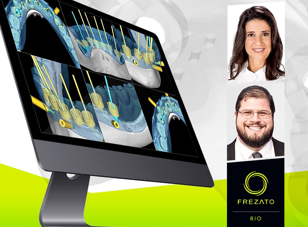 Implantodontia Digital: Planejamento Virtual e Cirurgia Guiada