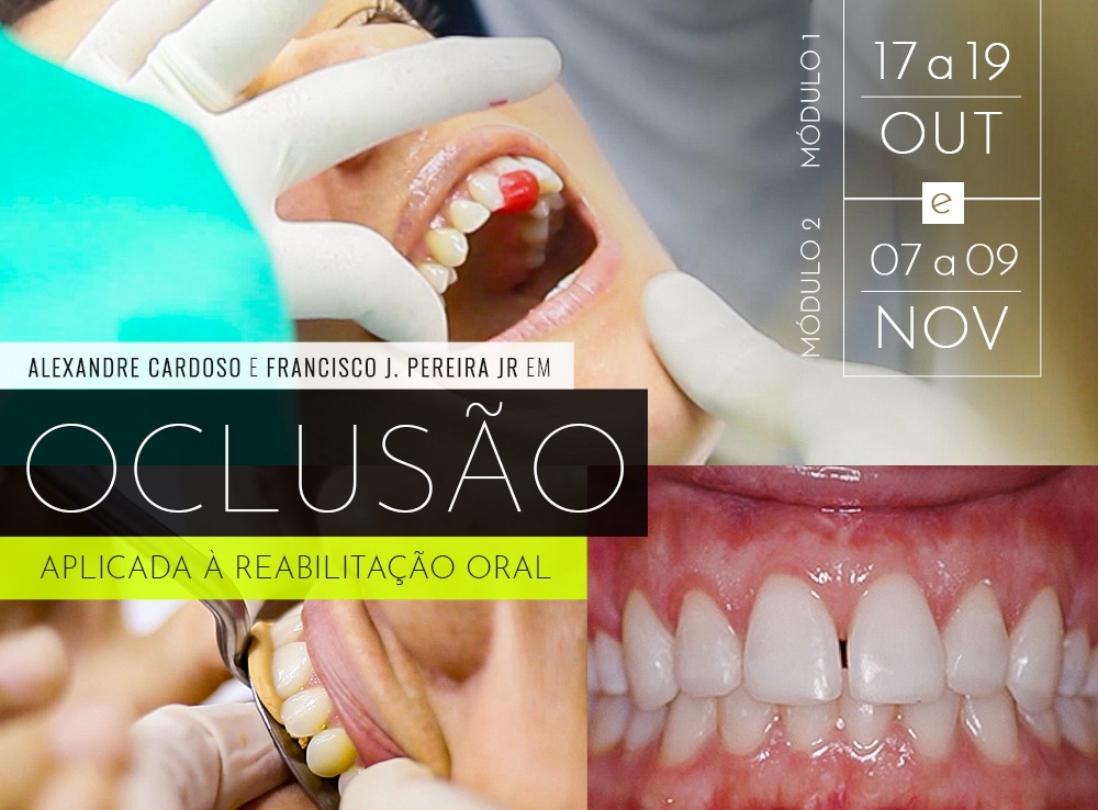 Oclusão Aplicada a Reabilitação Oral