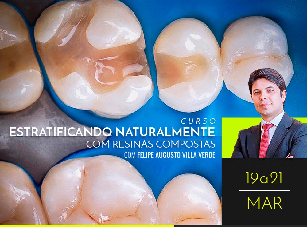 Estratificando Naturalmente com Resinas Compostas