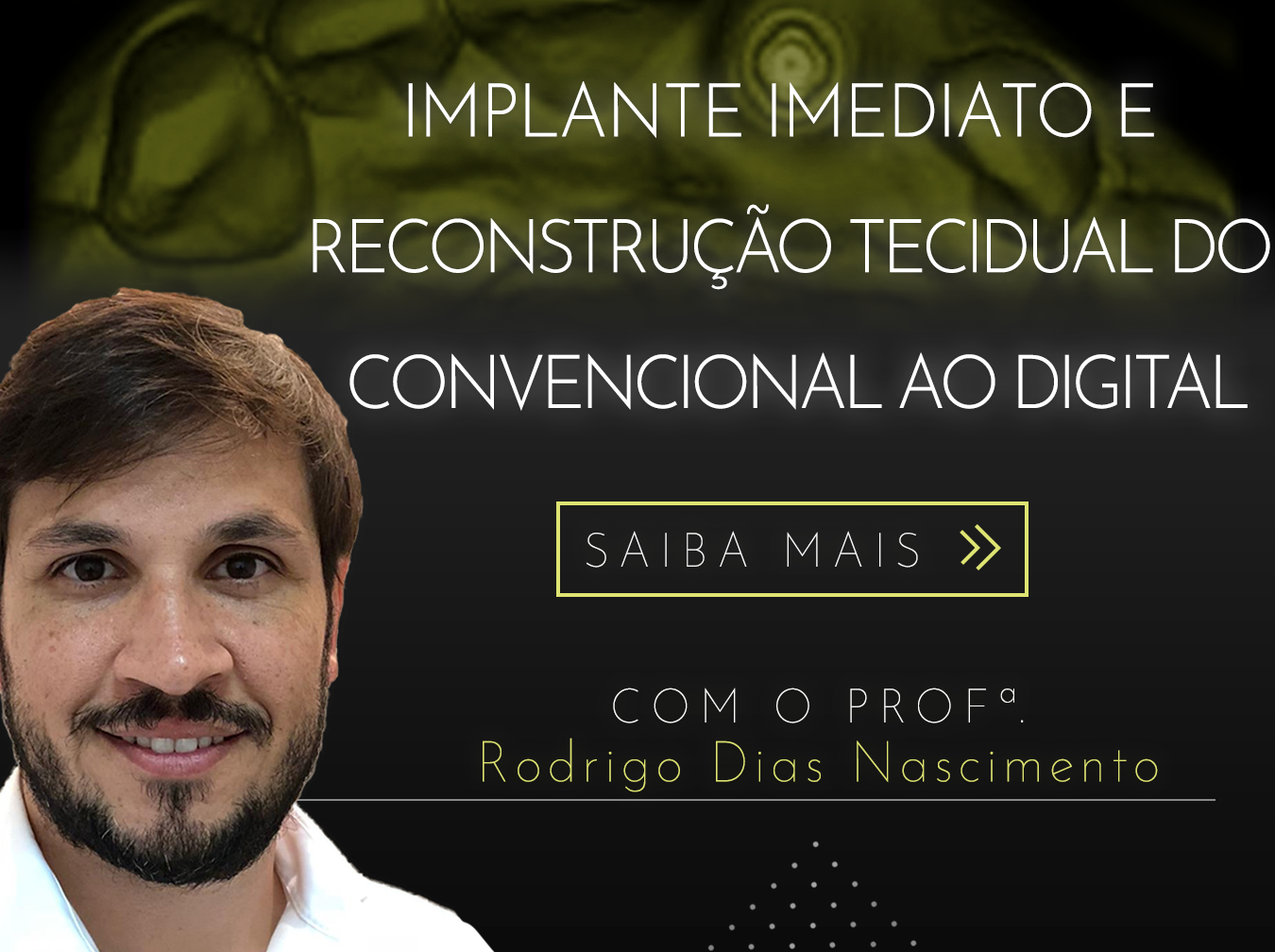 Implante Imediato e Reconstrução Tecidual – Como atingir os melhores resultados na área estética?