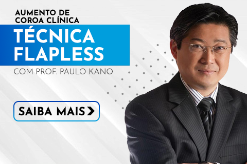 Técnica Flapless- Aumento De Coroa Clínica sem Retalho