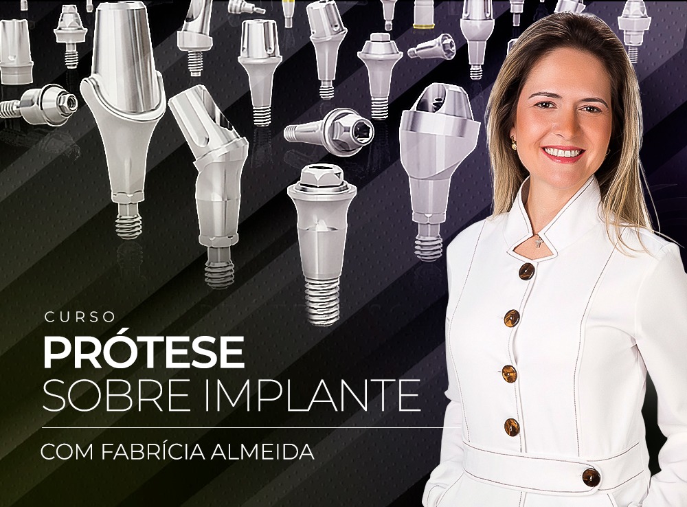 Princípios básicos da prótese sobre implante